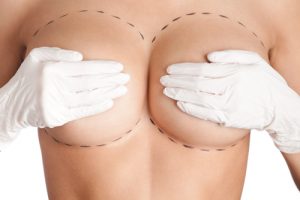 Gloved Hands Covering Breasts