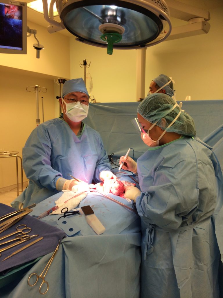 dr steve yu fibroid treatment surgery